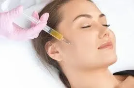 Plasma rico en plaquetas PRP: regeneración biológica y diseño facial